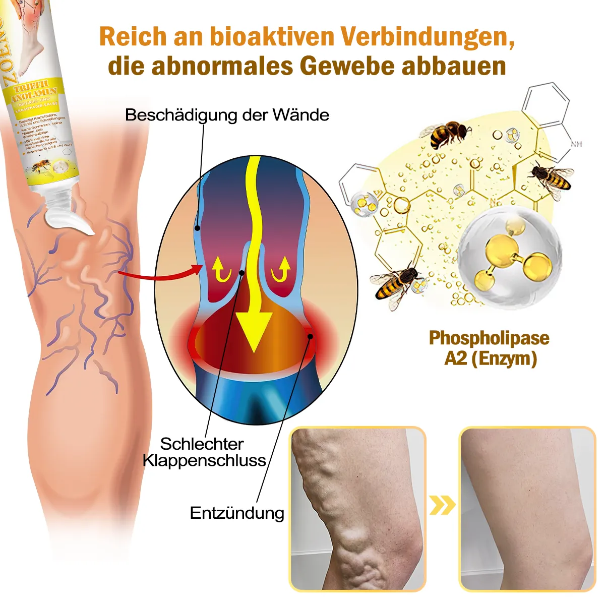 🐝🌈[✨𝐎𝐟𝐟𝐢𝐜𝐢𝐚𝐥 𝐁𝐫𝐚𝐧𝐝 𝐒𝐭𝐨𝐫𝐞✨]Zoencgz™ Bienengiftcreme zur Behandlung von Arthritis und Krampfadern（CE & GMP RECOMMENDS）