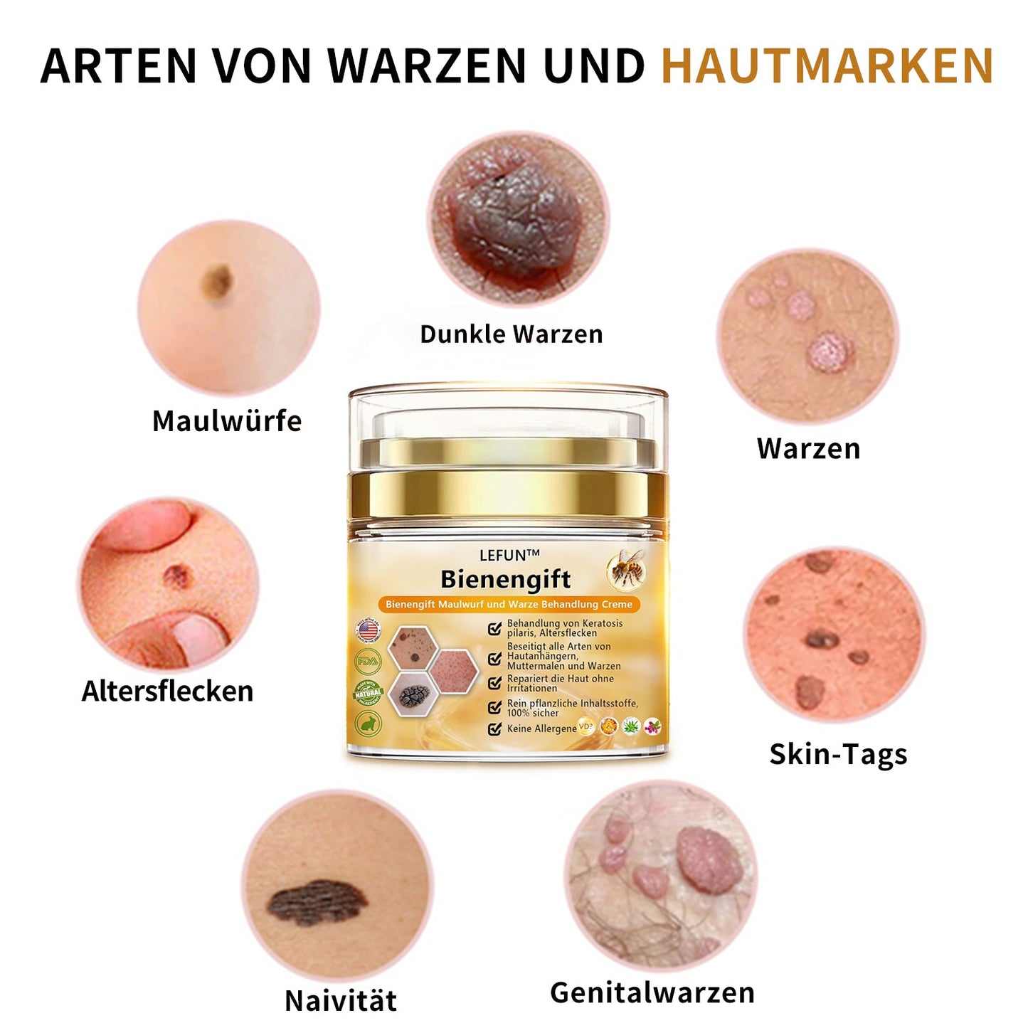 🌻🐝[🌟Offizieller Markenshop🌟] LEFUN™ Bienengift Maulwurf und Warze Behandlung Creme(👨‍⚕AAD EMPFIEHLT)