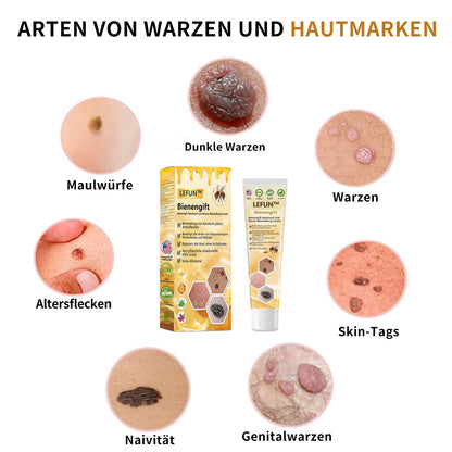 🌻🐝[🍀Offizieller Markenshop🍀] LEFUN™ Bienengift Maulwurf und Warze Behandlung Creme(👨‍⚕AAD EMPFIEHLT)