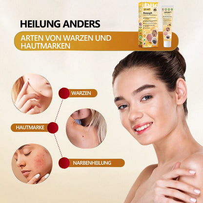 🌻🐝[🍀Offizieller Markenshop🍀] LEFUN™ Bienengift Maulwurf und Warze Behandlung Creme(👨‍⚕AAD EMPFIEHLT)