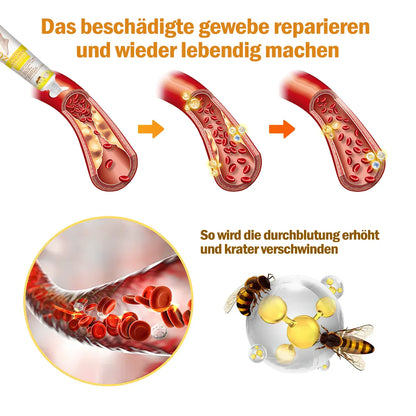 🐝🌈[✨𝐎𝐟𝐟𝐢𝐜𝐢𝐚𝐥 𝐁𝐫𝐚𝐧𝐝 𝐒𝐭𝐨𝐫𝐞✨]Zoencgz™ Bienengiftcreme zur Behandlung von Arthritis und Krampfadern（CE & GMP RECOMMENDS）