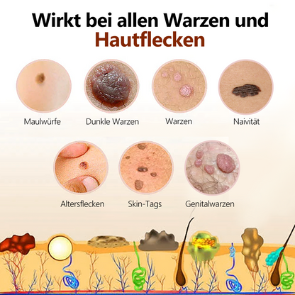 🌻🐝[🍀Offizieller Markenshop🍀] LEFUN™ Bienengift Maulwurf und Warze Behandlung Creme(👨‍⚕AAD EMPFIEHLT)