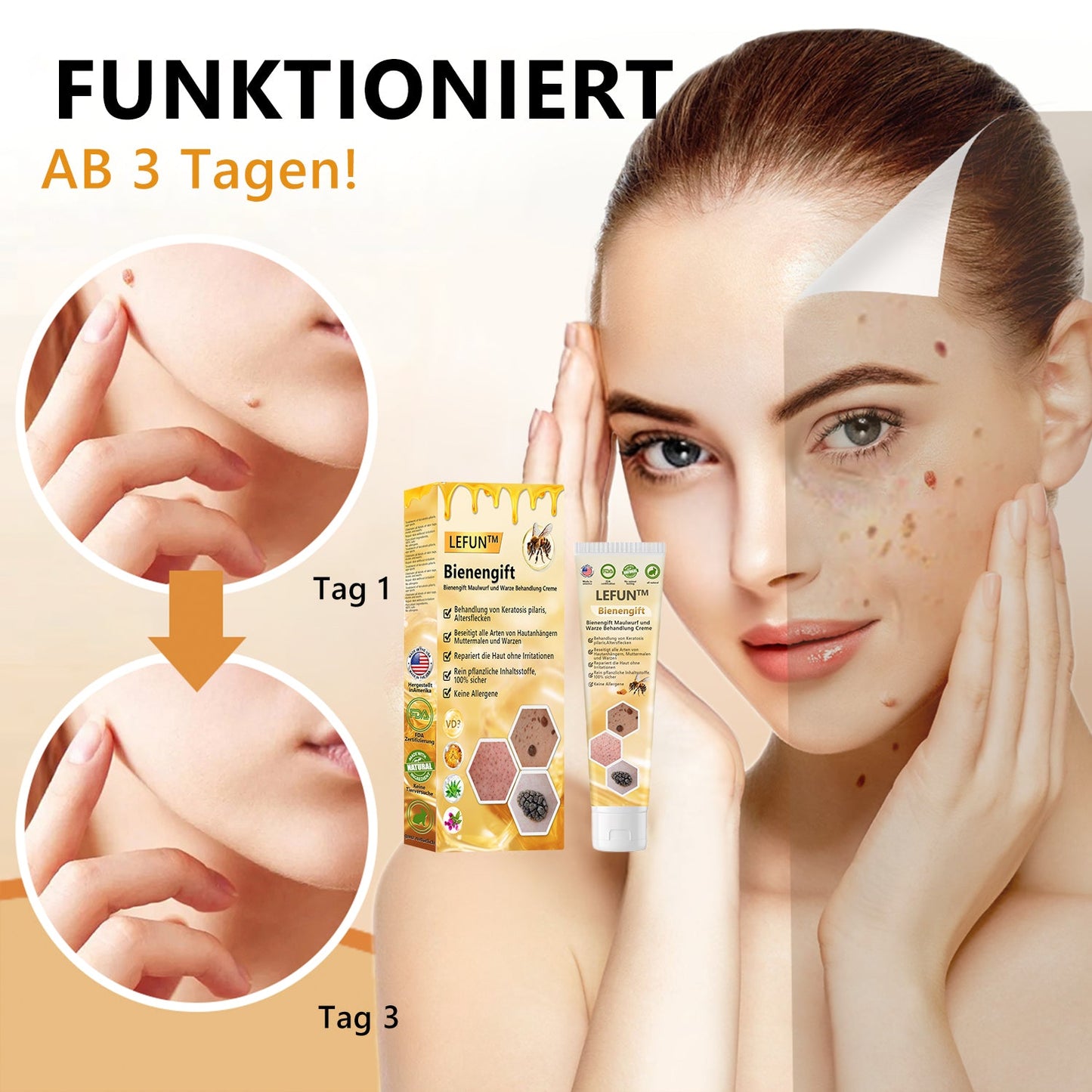 🌻🐝[🍀Offizieller Markenshop🍀] LEFUN™ Bienengift Maulwurf und Warze Behandlung Creme(👨‍⚕AAD EMPFIEHLT)