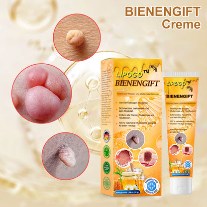 👑👑LIPOGO™ Bienengift Warze & Tag Entfernung Creme(👨‍⚕Für alle Hauttypen geeignet)🐝(🔥Aktion am letzten Tag 70% Rabatt)