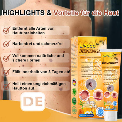 👑👑LIPOGO™ Bienengift Warze & Tag Entfernung Creme(👨‍⚕Für alle Hauttypen geeignet)🐝(🔥Aktion am letzten Tag 70% Rabatt)