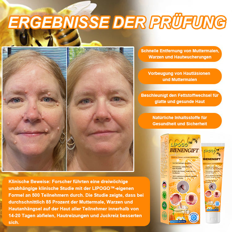 👑👑LIPOGO™ Bienengift Warze & Tag Entfernung Creme(👨‍⚕Für alle Hauttypen geeignet)🐝(🔥Aktion am letzten Tag 70% Rabatt)