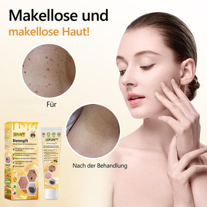 🌻🐝[🍀Offizieller Markenshop🍀] LEFUN™ Bienengift Maulwurf und Warze Behandlung Creme(👨‍⚕AAD EMPFIEHLT)