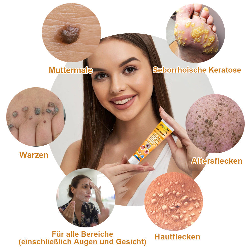 👑👑LIPOGO™ Bienengift Warze & Tag Entfernung Creme(👨‍⚕Für alle Hauttypen geeignet)🐝(🔥Aktion am letzten Tag 70% Rabatt)