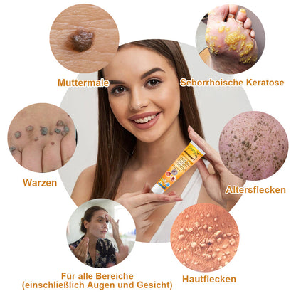 👑👑LIPOGO™ Bienengift Warze & Tag Entfernung Creme(👨‍⚕Für alle Hauttypen geeignet)🐝(🔥Aktion am letzten Tag 70% Rabatt)