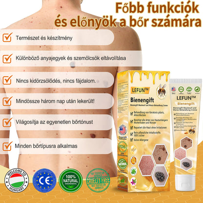 🌻🐝[🍀Offizieller Markenshop🍀] LEFUN™ Bienengift Maulwurf und Warze Behandlung Creme(👨‍⚕AAD EMPFIEHLT)