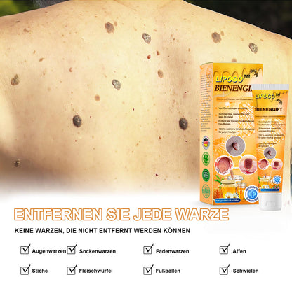 👑👑LIPOGO™ Bienengift Warze & Tag Entfernung Creme(👨‍⚕Für alle Hauttypen geeignet)🐝(🔥Aktion am letzten Tag 70% Rabatt)