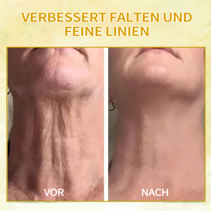 🌟🌟𝐋𝐚𝐬𝐭 𝐃𝐚𝐲 𝐃𝐢𝐬𝐜𝐨𝐮𝐧𝐭: 𝟕𝟎% 𝐎𝐅𝐅 LEFUN® Hautstraffendes Verjüngungsöl