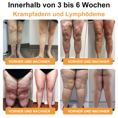 Voilaist™ Bienenlymphatischer Drainage- & schlankender Fußbad-Körner (Für alle lymphatischen Probleme und Ödeme)-Empfehlung des Arztes