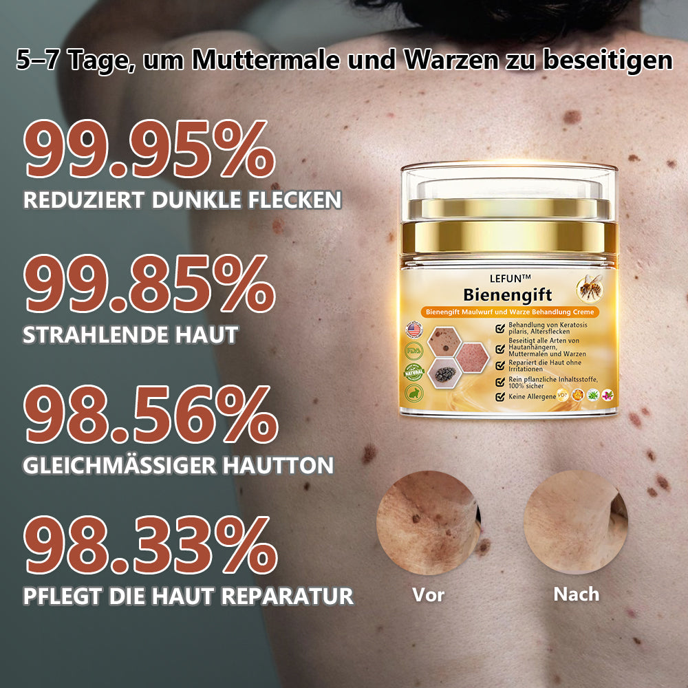 🌻🐝[🌟Offizieller Markenshop🌟] LEFUN™ Bienengift Maulwurf und Warze Behandlung Creme(👨‍⚕AAD EMPFIEHLT)