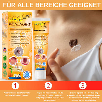 👑👑LIPOGO™ Bienengift Warze & Tag Entfernung Creme(👨‍⚕Für alle Hauttypen geeignet)🐝(🔥Aktion am letzten Tag 70% Rabatt)