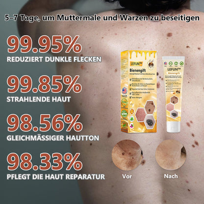 🌻🐝[🍀Offizieller Markenshop🍀] LEFUN™ Bienengift Maulwurf und Warze Behandlung Creme(👨‍⚕AAD EMPFIEHLT)