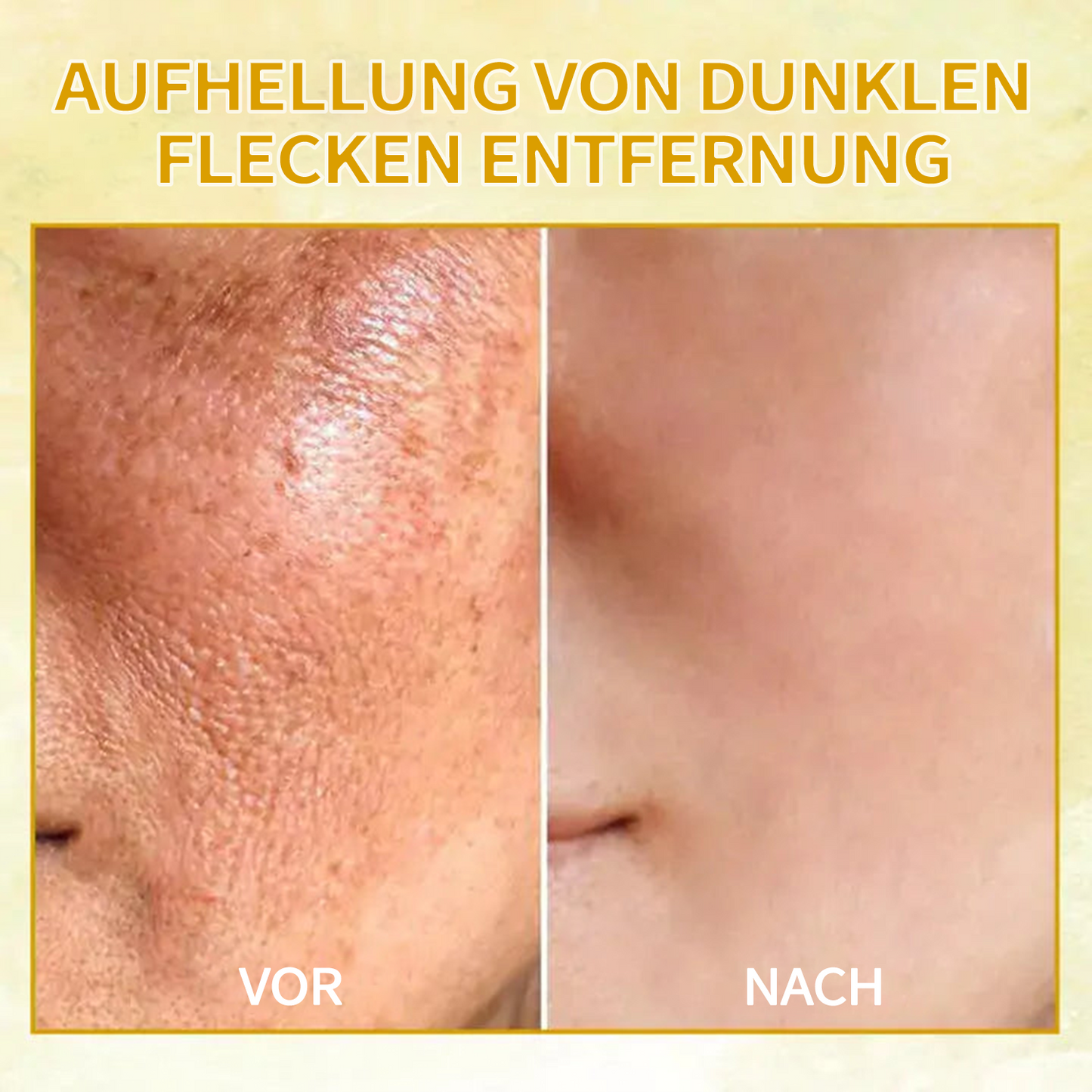 🌟🌟𝐋𝐚𝐬𝐭 𝐃𝐚𝐲 𝐃𝐢𝐬𝐜𝐨𝐮𝐧𝐭: 𝟕𝟎% 𝐎𝐅𝐅 LEFUN® Hautstraffendes Verjüngungsöl