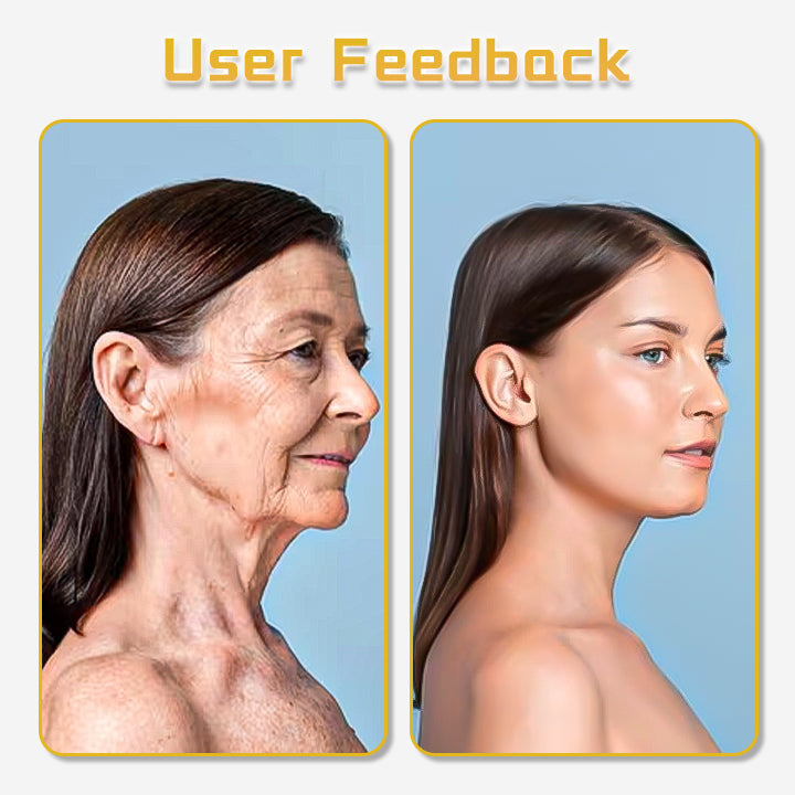 Fivfivgo™ UltraRenew-Ultraschall-Facelift-Gerät